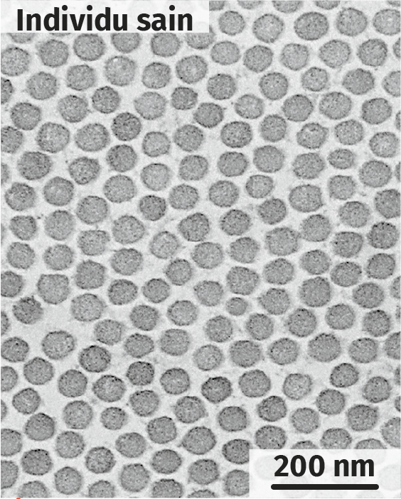 Observations microscopiques de fibres de collagène