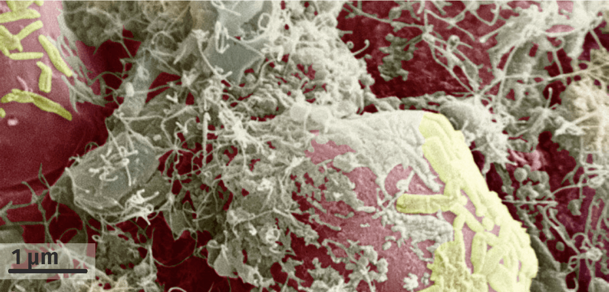 Cellules intestinales humaines recouvertes de leur microbiote (MEB, image colorisée).