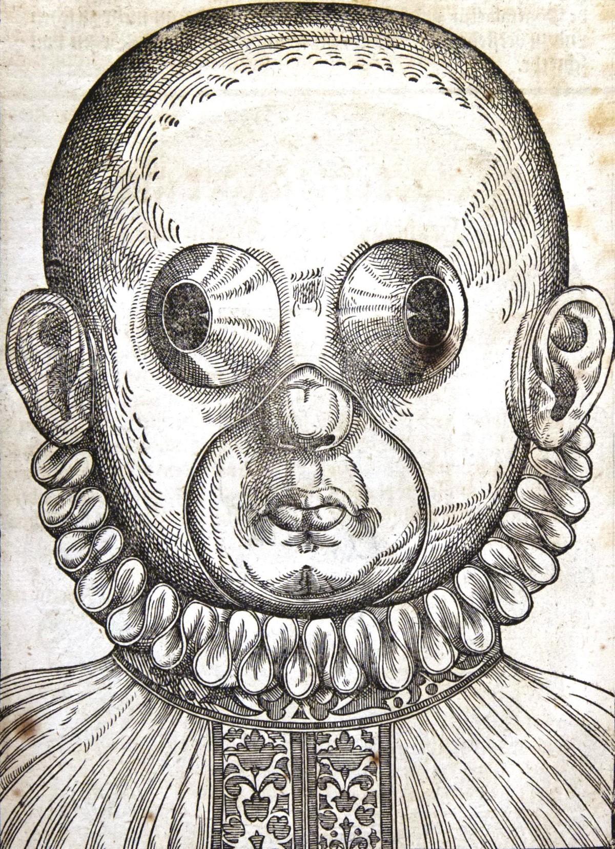 Masques pour le traitement des strabismes