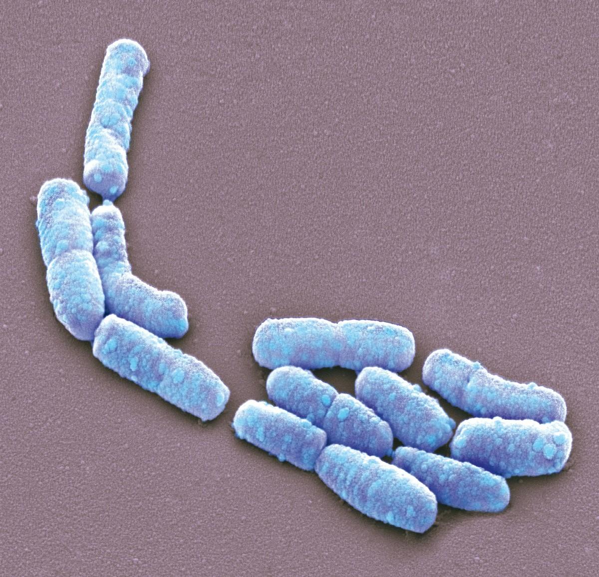Une observation au microscope électronique à balayage de bactéries présentes dans le tube digestif des mammifères, Escherichia coli (image colorisée).