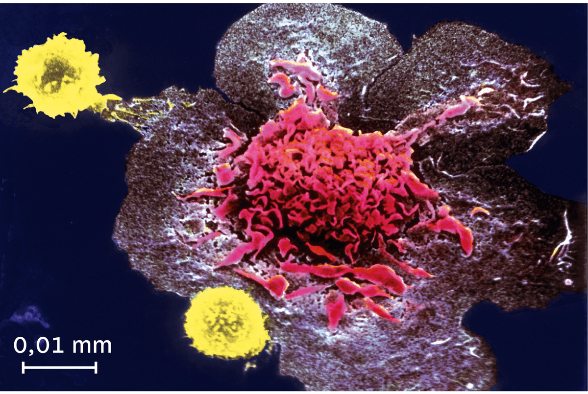 <stamp theme='svt-green1'>Doc. 3</stamp> La destruction d'une cellule infectée par des lymphocytes T observée au microscope électronique à balayage (image colorisée).