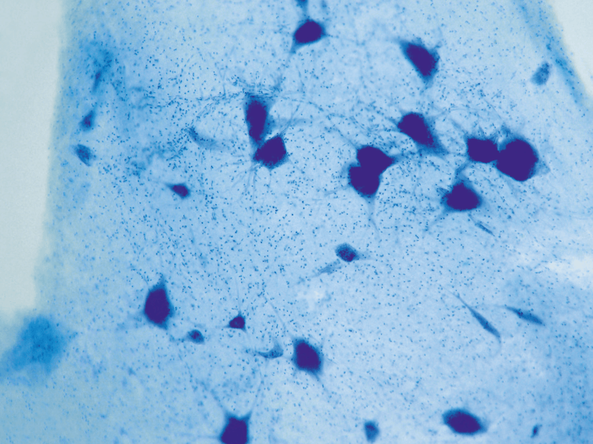 Photographie de cellules nerveuses humaines vues au microscope optique (x100).