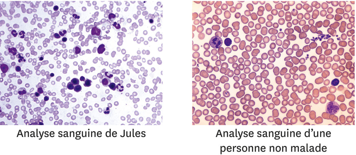 La comparaison du sang de Jules avec celui d'une personne non malade.