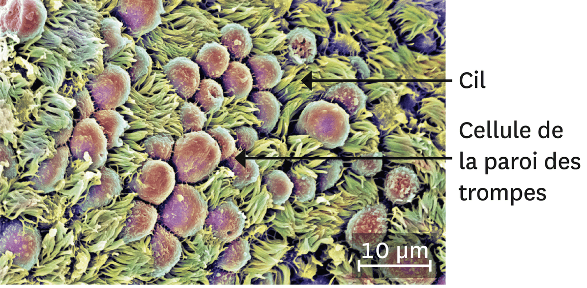 Une observation au microscope électronique de la paroi des trompes (image colorisée).