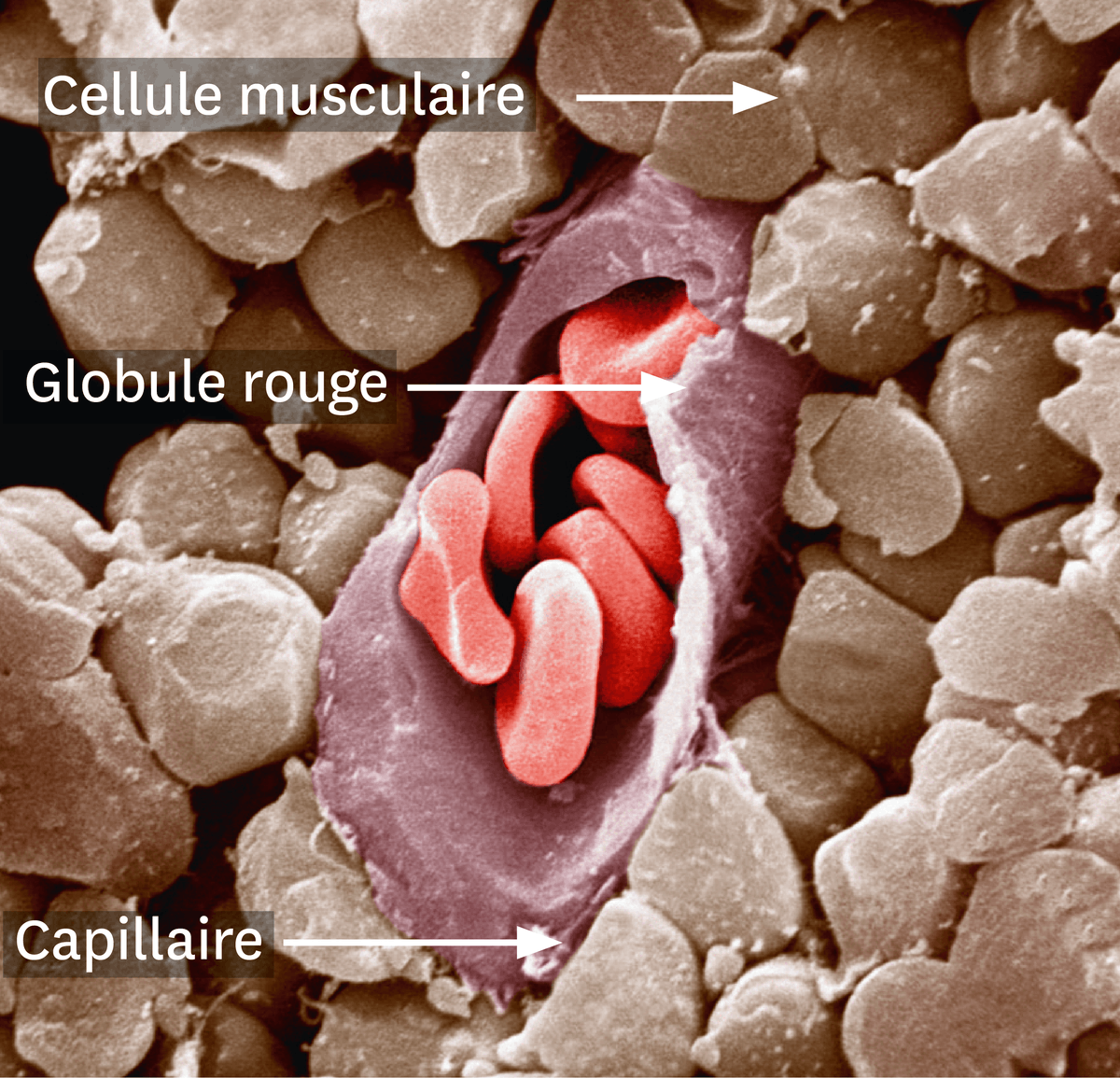 Une observation au microscope électronique à balayage d'un capillaire sanguin coupé au niveau d'un muscle. On peut observer la cellule musculaire et les globules rouges qui sortent du capillaire