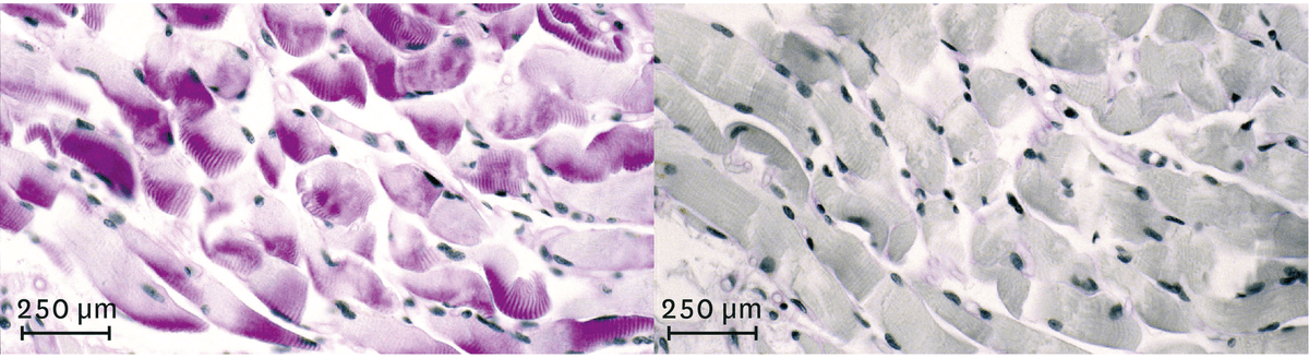Observation d'un muscle avant (à gauche en rose) et après (à droite en noir) un effort physique de quelques minutes au microscope optique.