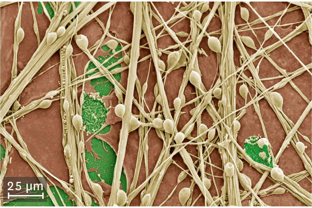 <stamp theme='svt-green1'>Doc. 2</stamp> Une culture de cellules nerveuses observées au microscope électronique à balayage.