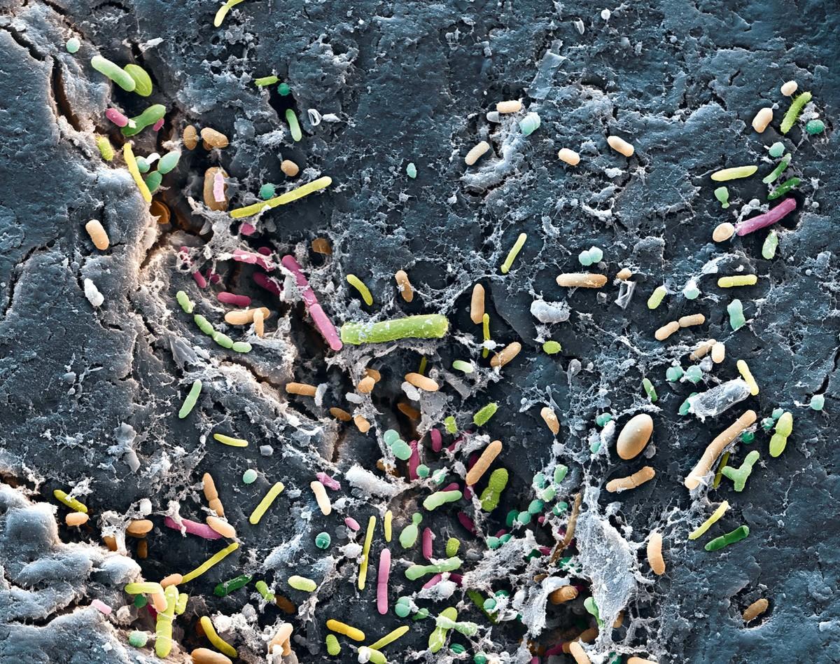Des bactéries dans l'intestin humain observées au microscope électronique à balayage (image colorisée).