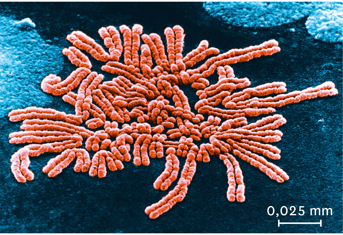 Une observation au microscope électronique à balayage des chromosomes au début de la division cellulaire.