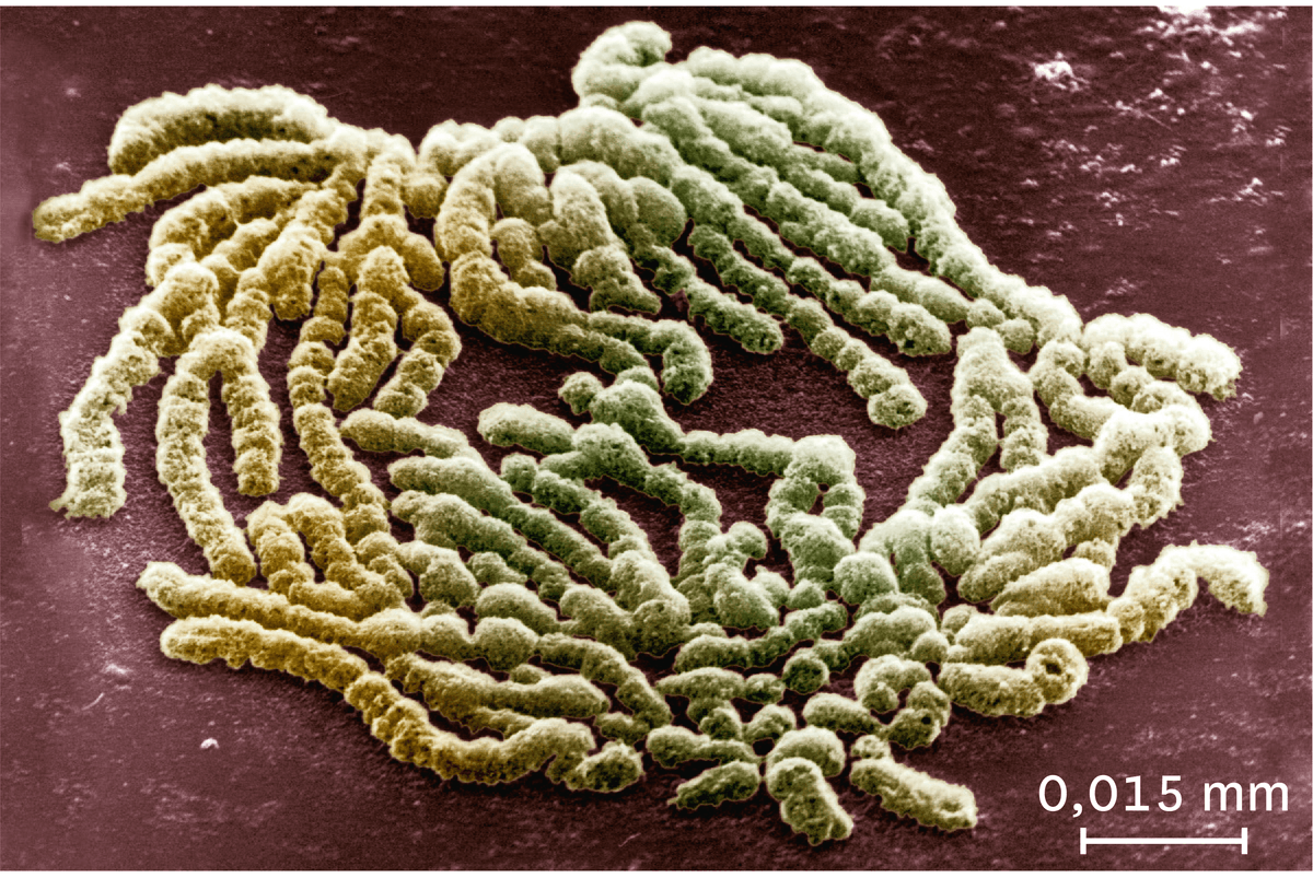 Une observation au microscope électronique à balayage des chromosomes au milieu de la division cellulaire.