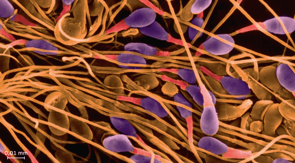 Spermatozoïdes vus au microscope électronique.