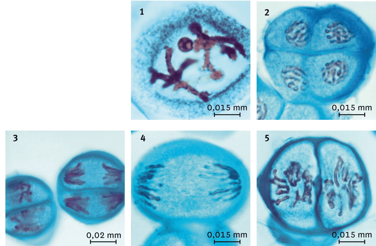 <stamp theme='svt-green1'>Doc. 1</stamp> Les étapes de la mélose vues au microscope optique.
