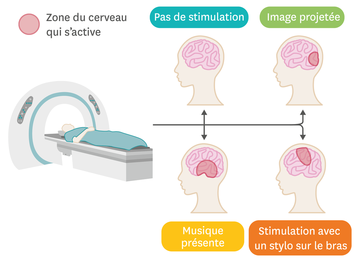 L'IRM permet de visualiser les zones d'activation du cerveau.