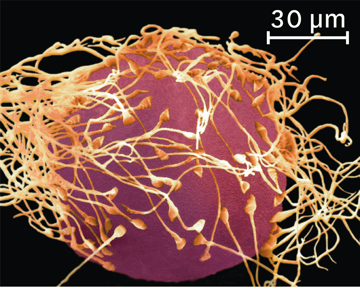 Une observation au microscope électronique d'une fécondation (image colorisée).