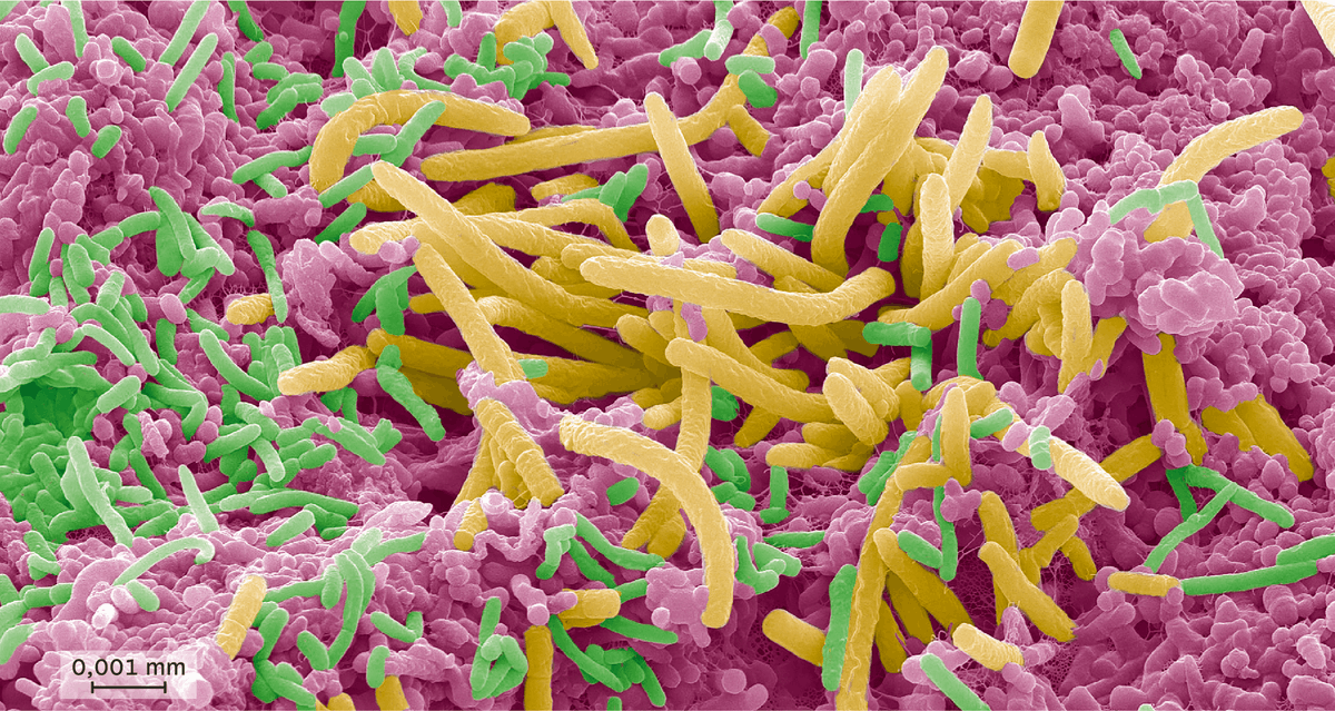 Des microorganismes à la surface de la langue (image colorisée)