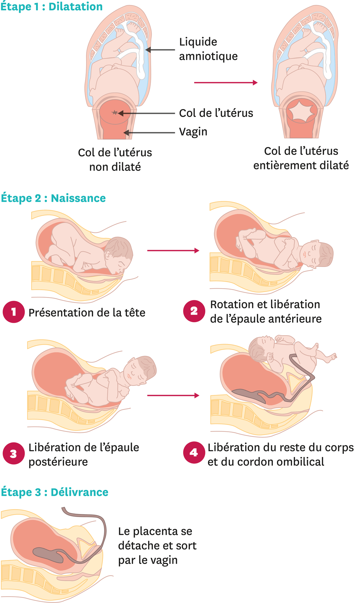 Les étapes de l'accouchement.