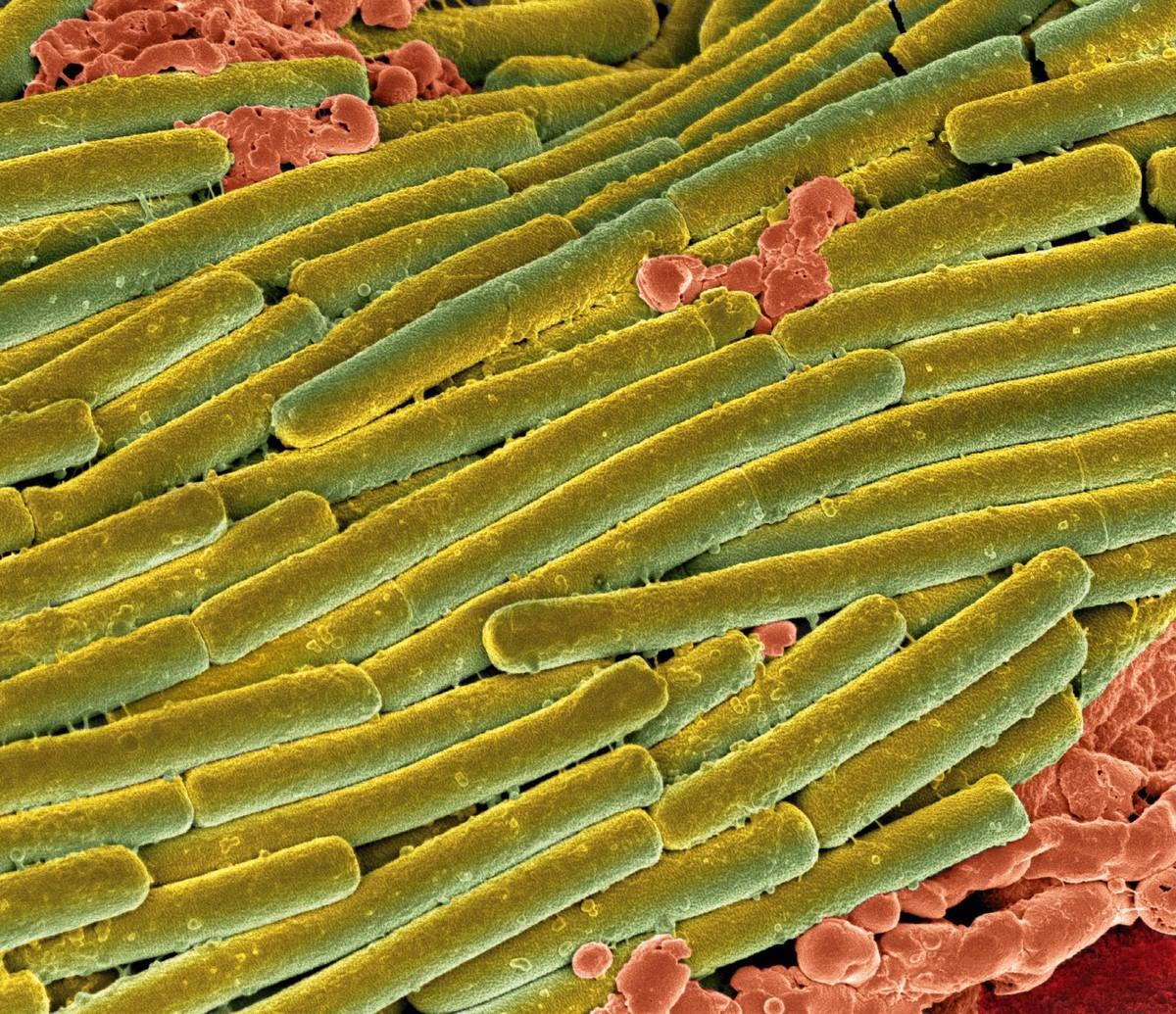 Des bactéries Clostridium difficile (en vert) couvrant des bactéries du microbiote (en rouge) lors d'une colite (image colorisée).