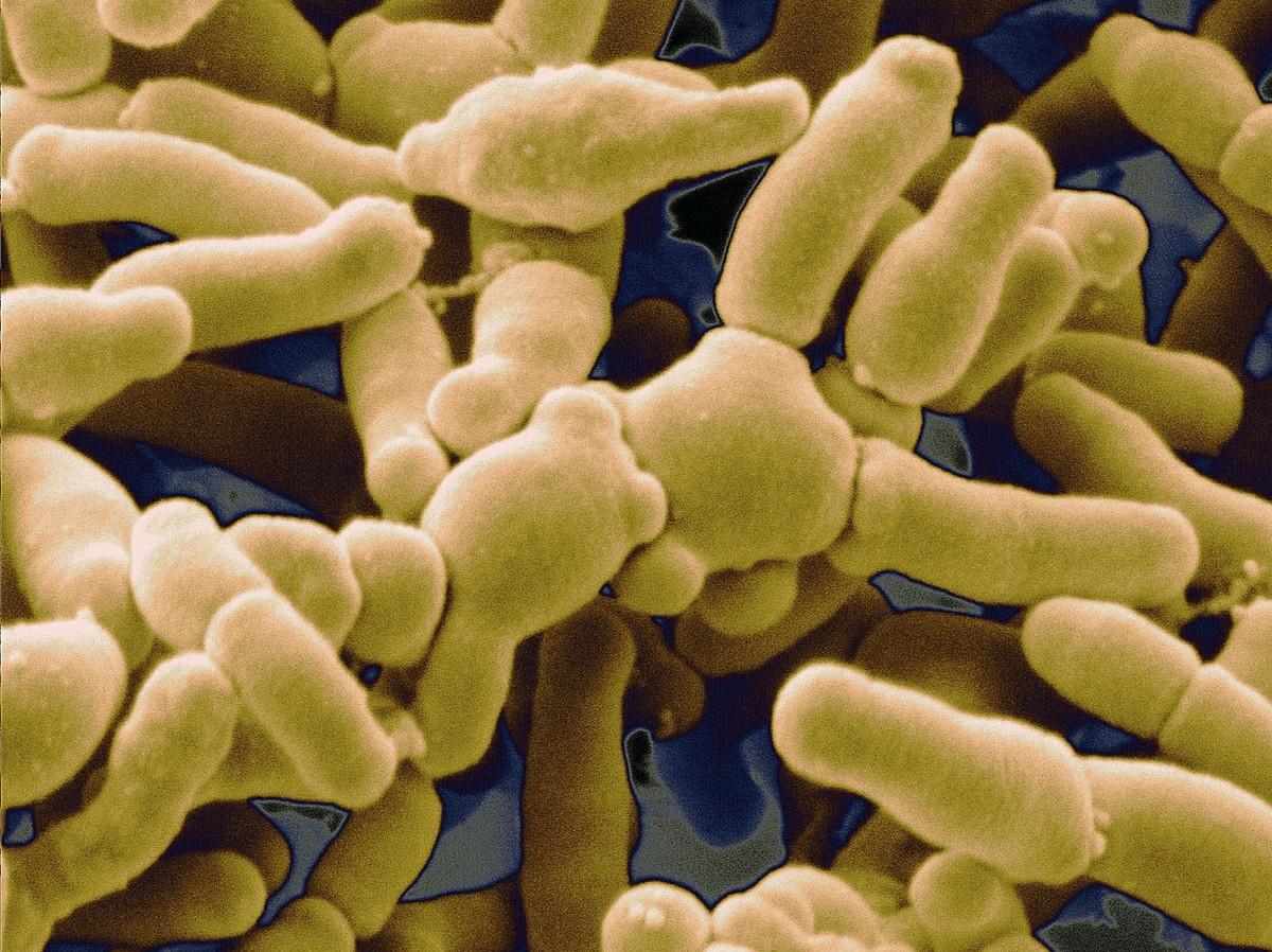 Bifidobacterium breve, une bactérie présente dans les probiotiques et compléments alimentaires.
