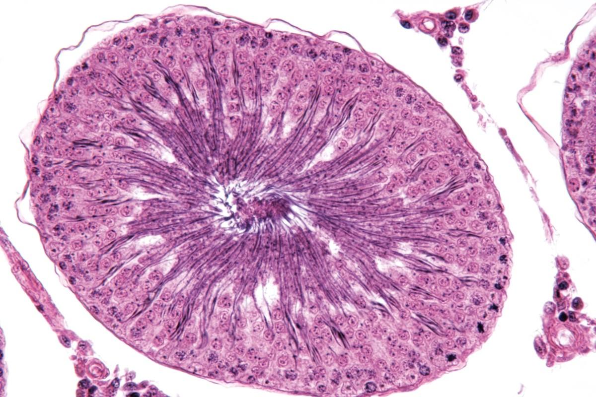  Une coupe transversale de testicule observée au microscope optique.