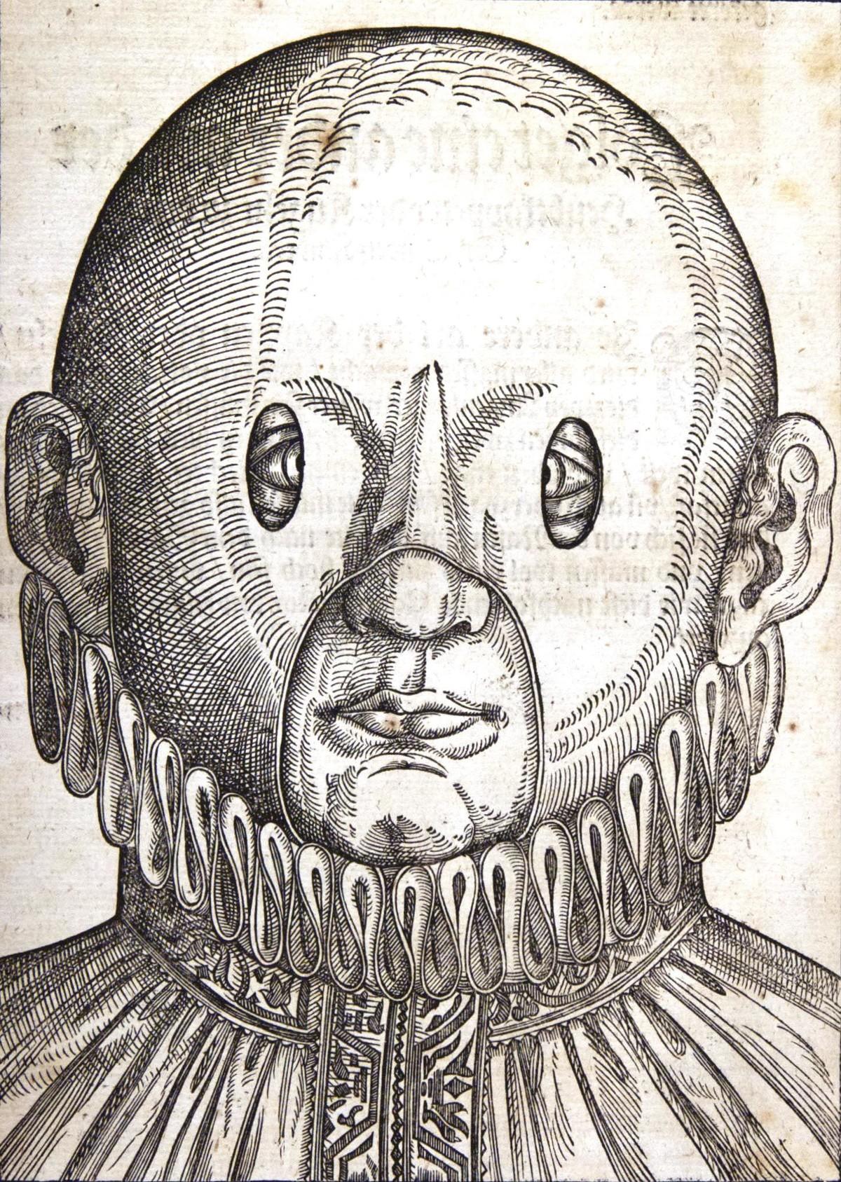 Masques pour le traitement des strabismes